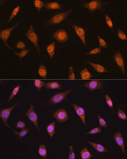 Immunocytochemistry/ Immunofluorescence: MAD2L2 Antibody [NBP3-35251] - Immunofluorescence analysis of L929 cells using MAD2L2 Rabbit pAb at dilution of 1:100. Blue: DAPI for nuclear staining.