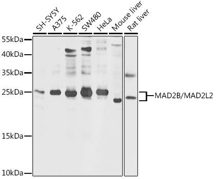 Western Blot: MAD2L2 Antibody [NBP3-35251] - Western blot analysis of various lysates using MAD2L2 Rabbit pAb at 1:1000 dilution.Secondary antibody: HRP-conjugated Goat anti-Rabbit IgG (H+L) at 1:10000 dilution.Lysates/proteins: 25ug per lane.Blocking buffer: 3% nonfat dry milk in TBST.Detection: ECL Basic Kit.Exposure time: 5s.