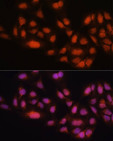 Immunocytochemistry/ Immunofluorescence: MAD2L2 Antibody [NBP3-35251] - Immunofluorescence analysis of U2OS cells using MAD2L2 Rabbit pAb at dilution of 1:100. Blue: DAPI for nuclear staining.