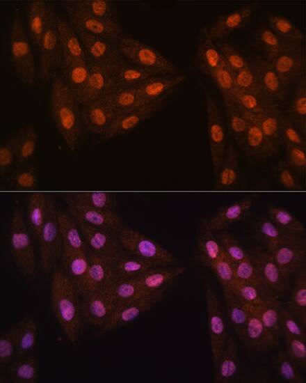 Immunocytochemistry/ Immunofluorescence: MAD2L2 Antibody [NBP3-35251] - Immunofluorescence analysis of H9C2 cells using MAD2L2 Rabbit pAb at dilution of 1:100. Blue: DAPI for nuclear staining.