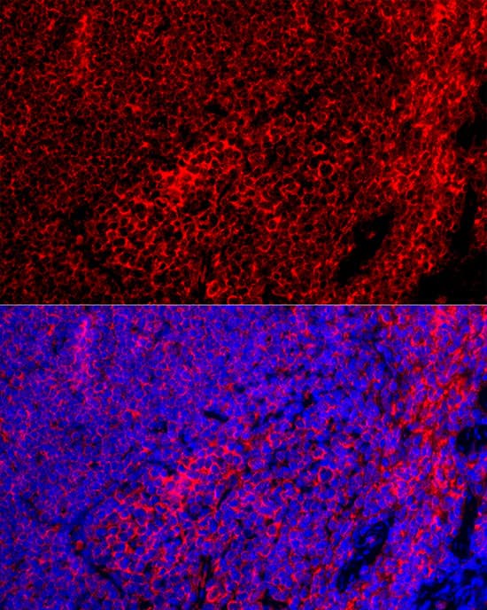 Immunocytochemistry/ Immunofluorescence: EMR1 Antibody [NBP3-35252] - Immunofluorescence analysis of paraffin-embedded Mouse spleen using EMR1 Rabbit pAb at dilution of  1:100 (40x lens). Secondary antibody: Cy3-conjugated Goat anti-Rabbit IgG (H+L) at 1:500 dilution. Blue: DAPI for nuclear staining.