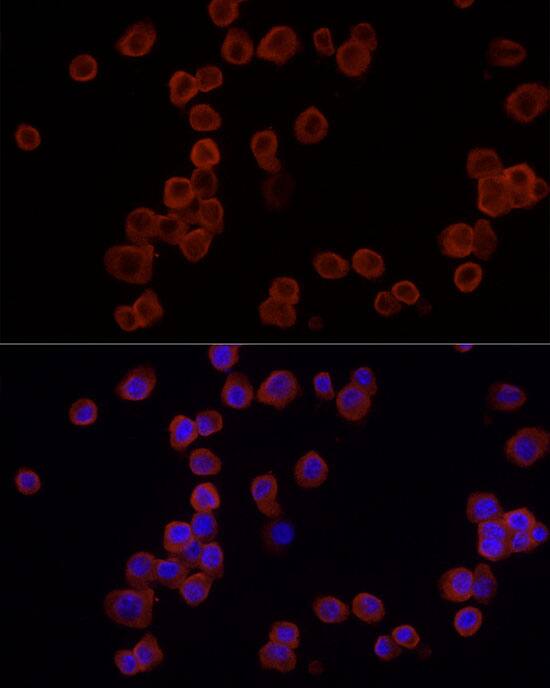 Immunocytochemistry/ Immunofluorescence: EMR1 Antibody [NBP3-35252] - Immunofluorescence analysis of RAW264.7 cells using EMR1 Rabbit pAb at dilution of 1:25 (40x lens). Secondary antibody: Cy3-conjugated Goat anti-Rabbit IgG (H+L) at 1:500 dilution. Blue: DAPI for nuclear staining.