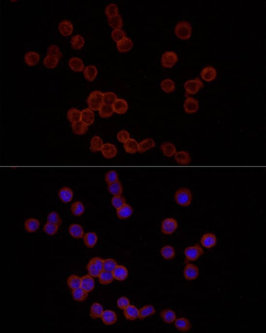 Immunocytochemistry/ Immunofluorescence: EMR1 Antibody [NBP3-35252] - Immunofluorescence analysis of THP-1 cells using EMR1 Rabbit pAb at dilution of 1:25 (40x lens). Secondary antibody: Cy3-conjugated Goat anti-Rabbit IgG (H+L) at 1:500 dilution. Blue: DAPI for nuclear staining.