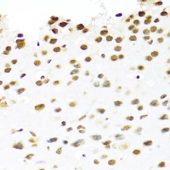 Immunohistochemistry: PRP19 Antibody [NBP3-35253] - Immunohistochemistry analysis of paraffin-embedded Mouse brain using PRP19 Rabbit pAb at dilution of 1:100 (40x lens). Microwave antigen retrieval performed with 0.01M PBS Buffer (pH 7.2) prior to IHC staining.