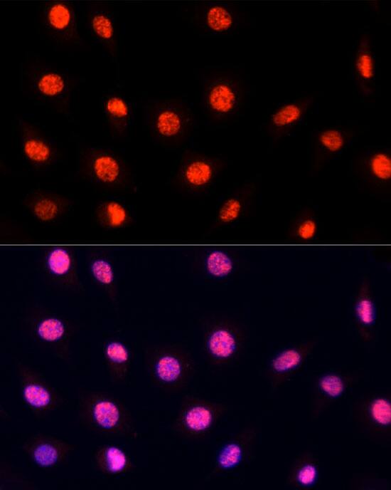 Immunocytochemistry/ Immunofluorescence: PRP19 Antibody [NBP3-35253] - Immunofluorescence analysis of L929 cells using PRP19 Rabbit pAb at dilution of 1:100 (40x lens). Secondary antibody: Cy3-conjugated Goat anti-Rabbit IgG (H+L) at 1:500 dilution. Blue: DAPI for nuclear staining.