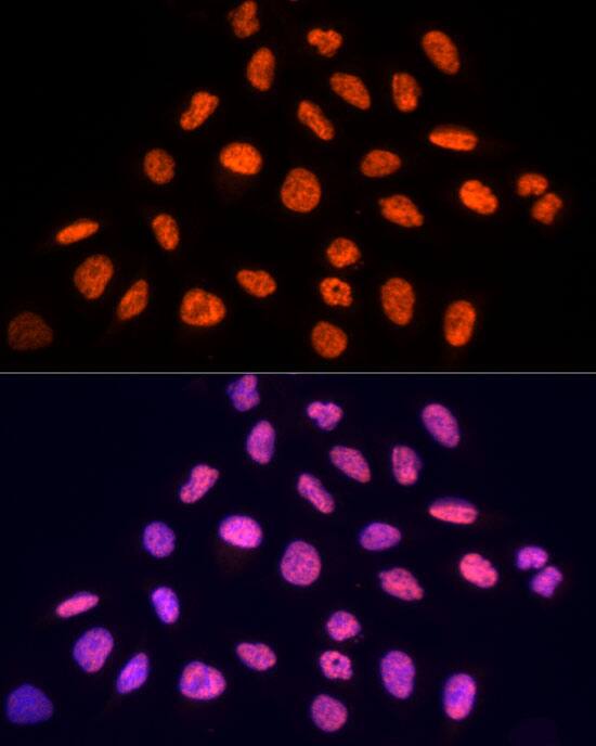 Immunocytochemistry/ Immunofluorescence: PRP19 Antibody [NBP3-35253] - Immunofluorescence analysis of U2OS cells using PRP19 Rabbit pAb at dilution of 1:100 (40x lens). Secondary antibody: Cy3-conjugated Goat anti-Rabbit IgG (H+L) at 1:500 dilution. Blue: DAPI for nuclear staining.