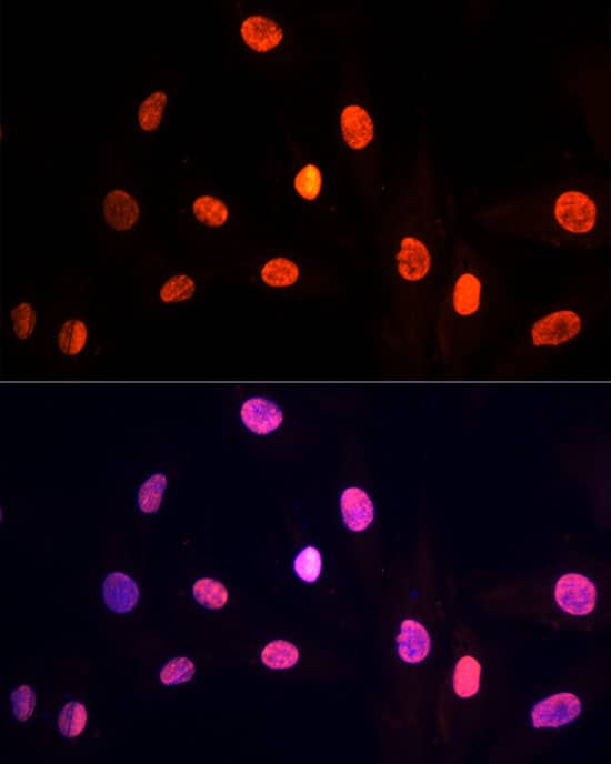 Immunocytochemistry/ Immunofluorescence: PRP19 Antibody [NBP3-35253] - Immunofluorescence analysis of H9C2 cells using PRP19 Rabbit pAb at dilution of 1:100 (40x lens). Secondary antibody: Cy3-conjugated Goat anti-Rabbit IgG (H+L) at 1:500 dilution. Blue: DAPI for nuclear staining.