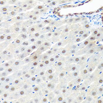 Immunohistochemistry PRP19 Antibody