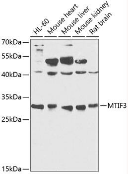 Western Blot: Mitocondrial Translational Initiation Factor 3 Antibody [NBP3-35257] - Western blot analysis of various lysates using Mitocondrial Translational Initiation Factor 3 Rabbit pAb at 1:1000 dilution.Secondary antibody: HRP-conjugated Goat anti-Rabbit IgG (H+L) at 1:10000 dilution.Lysates/proteins: 25ug per lane.Blocking buffer: 3% nonfat dry milk in TBST.Detection: ECL Basic Kit.Exposure time: 30s.