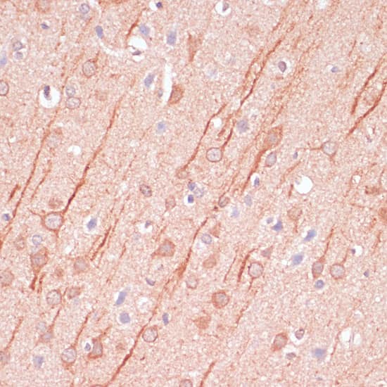 Immunohistochemistry: SAP102 Antibody [NBP3-35258] - Immunohistochemistry analysis of paraffin-embedded Rat brain using SAP102 Rabbit pAb at dilution of 1:100 (40x lens). Microwave antigen retrieval performed with 0.01M PBS Buffer (pH 7.2) prior to IHC staining.