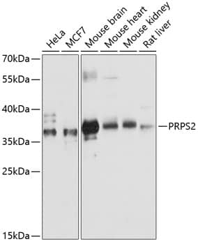 Western Blot: PRPS2 Antibody [NBP3-35260] - Western blot analysis of various lysates using PRPS2 Rabbit pAb at 1:3000 dilution.Secondary antibody: HRP-conjugated Goat anti-Rabbit IgG (H+L) at 1:10000 dilution.Lysates/proteins: 25ug per lane.Blocking buffer: 3% nonfat dry milk in TBST.Detection: ECL Basic Kit.Exposure time: 30s.