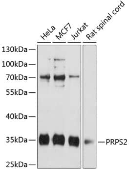 Western Blot: PRPS2 Antibody [NBP3-35261] - Western blot analysis of various lysates using PRPS2 Rabbit pAb at 1:3000 dilution.Secondary antibody: HRP-conjugated Goat anti-Rabbit IgG (H+L) at 1:10000 dilution.Lysates/proteins: 25ug per lane.Blocking buffer: 3% nonfat dry milk in TBST.Detection: ECL Basic Kit.Exposure time: 30s.