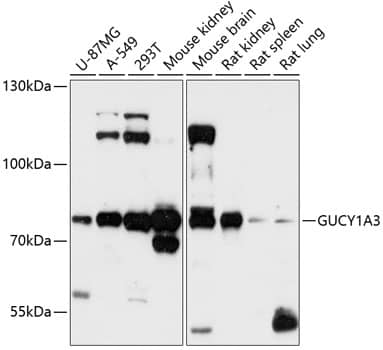 Western Blot: Guanylyl Cyclase alpha 1 Antibody [NBP3-35266] - Western blot analysis of various lysates using Guanylyl Cyclase alpha 1 Rabbit pAb at 1:3000 dilution.Secondary antibody: HRP-conjugated Goat anti-Rabbit IgG (H+L) at 1:10000 dilution.Lysates/proteins: 25ug per lane.Blocking buffer: 3% nonfat dry milk in TBST.Detection: ECL Enhanced Kit.Exposure time: 90s.