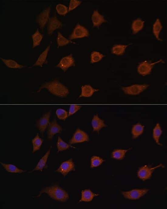 Immunocytochemistry/ Immunofluorescence: LSM1 Antibody [NBP3-35267] - Immunofluorescence analysis of L929 cells using LSM1 Rabbit pAb at dilution of 1:100. Secondary antibody: Cy3-conjugated Goat anti-Rabbit IgG (H+L) at 1:500 dilution. Blue: DAPI for nuclear staining.