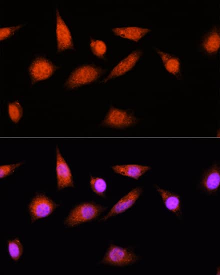 Immunocytochemistry/ Immunofluorescence COPS8 Antibody