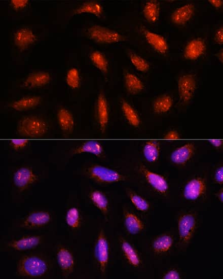 Immunocytochemistry/ Immunofluorescence COPS8 Antibody