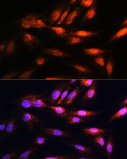 Immunocytochemistry/ Immunofluorescence: COPS8 Antibody [NBP3-35268] - Immunofluorescence analysis of H9C2 cells using COPS8 Rabbit pAb at dilution of 1:100. Secondary antibody: Cy3-conjugated Goat anti-Rabbit IgG (H+L) at 1:500 dilution. Blue: DAPI for nuclear staining.