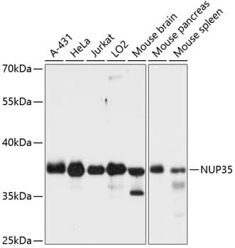 Western Blot: Nup53 Antibody [NBP3-35269] - Western blot analysis of various lysates using Nup53 Rabbit pAb at 1:3000 dilution.Secondary antibody: HRP-conjugated Goat anti-Rabbit IgG (H+L) at 1:10000 dilution.Lysates/proteins: 25ug per lane.Blocking buffer: 3% nonfat dry milk in TBST.Detection: ECL Basic Kit.Exposure time: 5s.