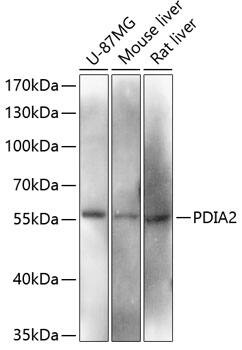 Western Blot: PDIA2 Antibody [NBP3-35272] - Western blot analysis of various lysates using PDIA2 Rabbit pAb at 1:3000 dilution.Secondary antibody: HRP-conjugated Goat anti-Rabbit IgG (H+L) at 1:10000 dilution.Lysates/proteins: 25ug per lane.Blocking buffer: 3% nonfat dry milk in TBST.Detection: ECL Basic Kit.Exposure time: 90s.