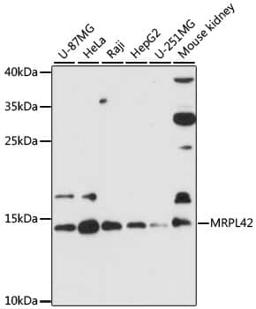 Western Blot: MRPL42 Antibody [NBP3-35273] - Western blot analysis of various lysates using MRPL42 Rabbit pAb at 1:3000 dilution.Secondary antibody: HRP-conjugated Goat anti-Rabbit IgG (H+L) at 1:10000 dilution.Lysates/proteins: 25ug per lane.Blocking buffer: 3% nonfat dry milk in TBST.Detection: ECL Basic Kit.Exposure time: 90s.