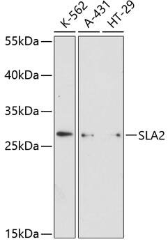 Western Blot: SLA2 Antibody [NBP3-35274] - Western blot analysis of various lysates using SLA2 Rabbit pAb at 1:3000 dilution.Secondary antibody: HRP-conjugated Goat anti-Rabbit IgG (H+L) at 1:10000 dilution.Lysates/proteins: 25ug per lane.Blocking buffer: 3% nonfat dry milk in TBST.Detection: ECL Enhanced Kit.Exposure time: 90s.