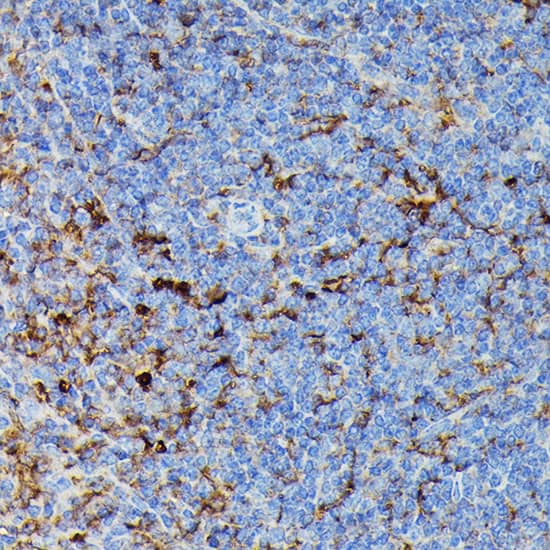 Immunohistochemistry HLA DPB1 Antibody