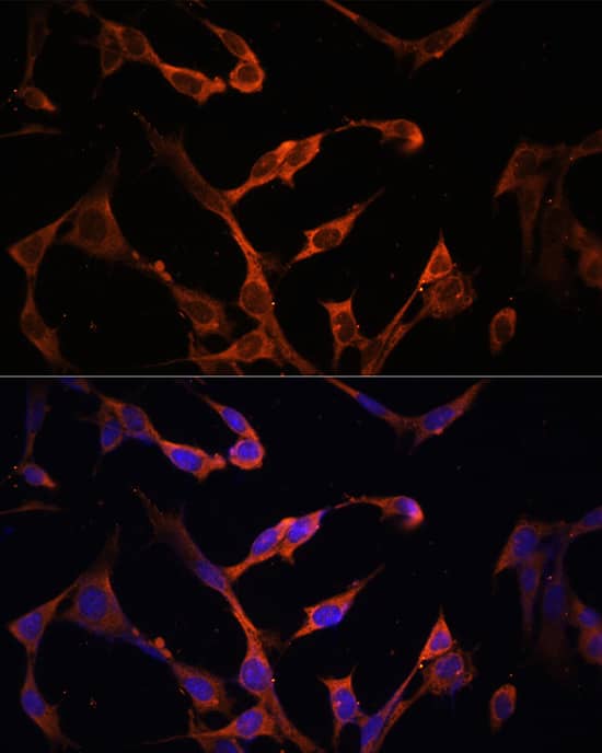 Immunohistochemistry: HLA DPB1 Antibody [NBP3-35275] - Immunohistochemistry analysis of paraffin-embedded Human lung tissue using HLA DPB1 Rabbit pAb  at a dilution of 1:100 (40x lens). High pressure antigen retrieval was performed with 0.01 M citrate buffer (pH 6.0) prior to IHC staining.