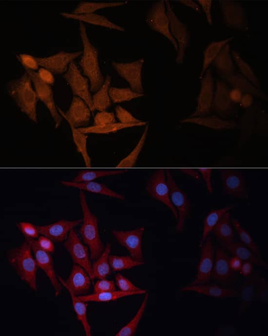 Immunohistochemistry: HLA DPB1 Antibody [NBP3-35275] - Immunohistochemistry analysis of paraffin-embedded Mouse spleen tissue using HLA DPB1 Rabbit pAb  at a dilution of 1:100 (40x lens). High pressure antigen retrieval was performed with 0.01 M citrate buffer (pH 6.0) prior to IHC staining.