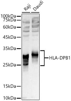 Western Blot: HLA DPB1 Antibody [NBP3-35275] - Western blot analysis of various lysates using HLA DPB1 Rabbit pAb at 1:1000 dilution.Secondary antibody: HRP-conjugated Goat anti-Rabbit IgG (H+L) at 1:10000 dilution.Lysates/proteins: 25ug per lane.Blocking buffer: 3% nonfat dry milk in TBST.Detection: ECL Basic Kit.Exposure time: 1s.