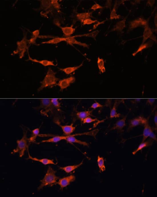 Immunohistochemistry HLA DPB1 Antibody