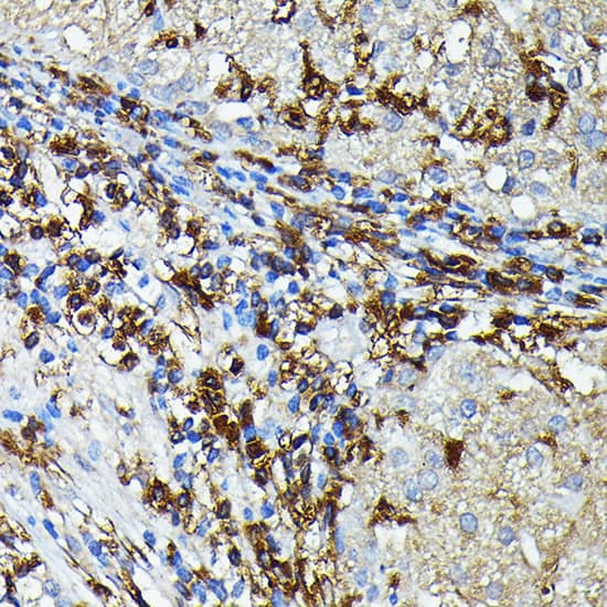 Western Blot HLA DPB1 Antibody