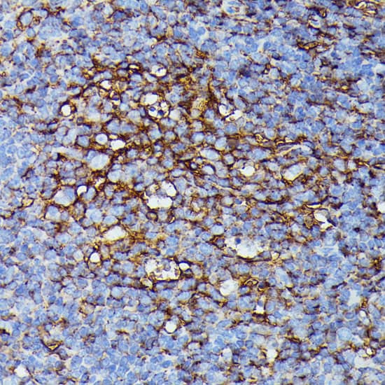 Immunohistochemistry: HLA B Antibody [NBP3-35277] - Immunohistochemistry analysis of paraffin-embedded Mouse spleen using HLA B Rabbit pAb at dilution of 1:100 (40x lens). Microwave antigen retrieval performed with 0.01M PBS Buffer (pH 7.2) prior to IHC staining.