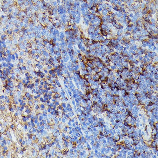 Immunohistochemistry: HLA B Antibody [NBP3-35277] - Immunohistochemistry analysis of paraffin-embedded Rat spleen using HLA B Rabbit pAb at dilution of 1:100 (40x lens). Microwave antigen retrieval performed with 0.01M PBS Buffer (pH 7.2) prior to IHC staining.