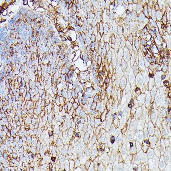 Immunohistochemistry: HLA B Antibody [NBP3-35277] - Immunohistochemistry analysis of paraffin-embedded Human esophageal using HLA B Rabbit pAb at dilution of 1:100 (40x lens). Microwave antigen retrieval performed with 0.01M PBS Buffer (pH 7.2) prior to IHC staining.