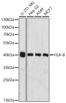 Western Blot: HLA B Antibody [NBP3-35277] - Western Blot analysis of various lysates using HLA B Rabbit pAb at 1:3000 dilution incubated overnight at 4C.Secondary antibody: HRP-conjugated Goat anti-Rabbit IgG (H+L) at 1:10000 dilution.Lysates/proteins: 25 ug per lane.Blocking buffer: 3% nonfat dry milk in TBST.Detection: ECL Basic Kit.Exposure time: 30s.