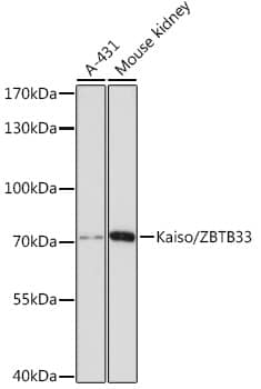 Western Blot: Kaiso Antibody [NBP3-35278] - Western blot analysis of various lysates using Kaiso Rabbit pAb at 1:3000 dilution.Secondary antibody: HRP-conjugated Goat anti-Rabbit IgG (H+L) at 1:10000 dilution.Lysates/proteins: 25ug per lane.Blocking buffer: 3% nonfat dry milk in TBST.Detection: ECL Basic Kit.Exposure time: 90s.