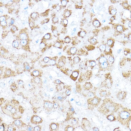 Immunohistochemistry: Kaiso Antibody [NBP3-35278] - Immunohistochemistry analysis of paraffin-embedded Human liver using Kaiso Rabbit pAb at dilution of 1:300 (40x lens). High pressure antigen retrieval performed with 0.01M Citrate Bufferr (pH 6.0) prior to IHC staining.