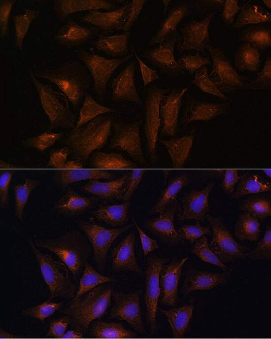 Immunocytochemistry/ Immunofluorescence: CRYZ Antibody [NBP3-35279] - Immunofluorescence analysis of U-2 OS cells using CRYZ Rabbit pAb at dilution of 1:100 (40x lens). Secondary antibody: Cy3-conjugated Goat anti-Rabbit IgG (H+L) at 1:500 dilution. Blue: DAPI for nuclear staining.