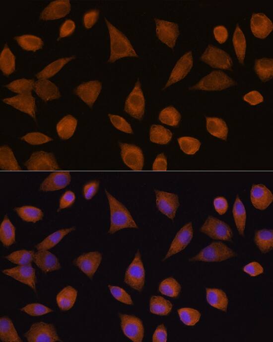 Immunocytochemistry/ Immunofluorescence: CRYZ Antibody [NBP3-35279] - Immunofluorescence analysis of L929 cells using CRYZ Rabbit pAb at dilution of 1:100 (40x lens). Secondary antibody: Cy3-conjugated Goat anti-Rabbit IgG (H+L) at 1:500 dilution. Blue: DAPI for nuclear staining.