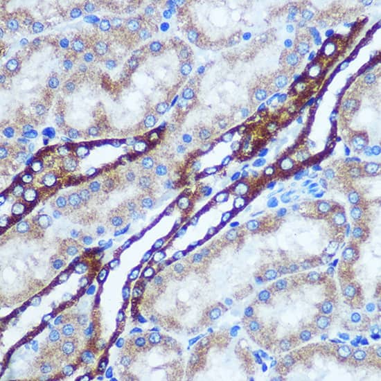 Immunohistochemistry: GSTT1 Antibody [NBP3-35280] - Immunohistochemistry analysis of paraffin-embedded Rat kidney using GSTT1 Rabbit pAb at dilution of 1:100 (40x lens). Microwave antigen retrieval performed with 0.01M PBS Buffer (pH 7.2) prior to IHC staining.