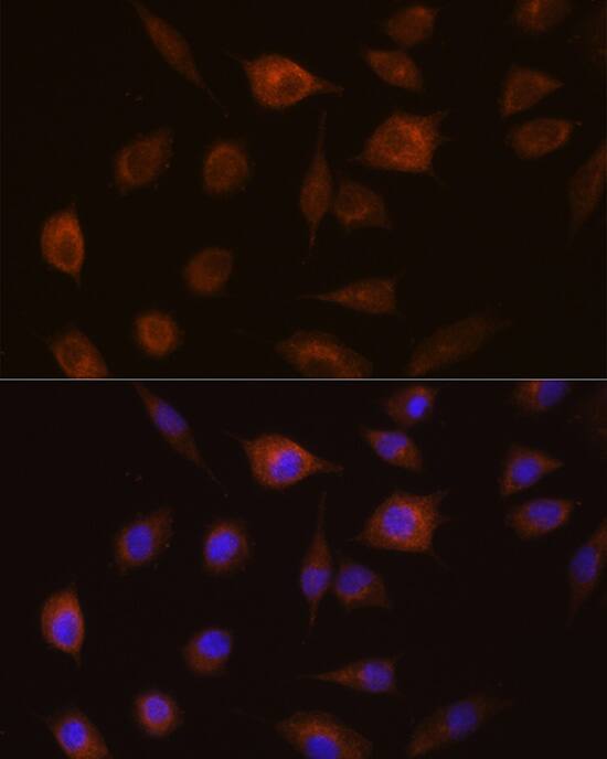 Immunocytochemistry/ Immunofluorescence: GSTT1 Antibody [NBP3-35280] - Immunofluorescence analysis of L929 cells using GSTT1 Rabbit pAb at dilution of 1:100 (40x lens). Secondary antibody: Cy3-conjugated Goat anti-Rabbit IgG (H+L) at 1:500 dilution. Blue: DAPI for nuclear staining.