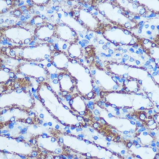 Immunohistochemistry: GSTT1 Antibody [NBP3-35280] - Immunohistochemistry analysis of paraffin-embedded Mouse kidney using GSTT1 Rabbit pAb at dilution of 1:100 (40x lens). Microwave antigen retrieval performed with 0.01M PBS Buffer (pH 7.2) prior to IHC staining.