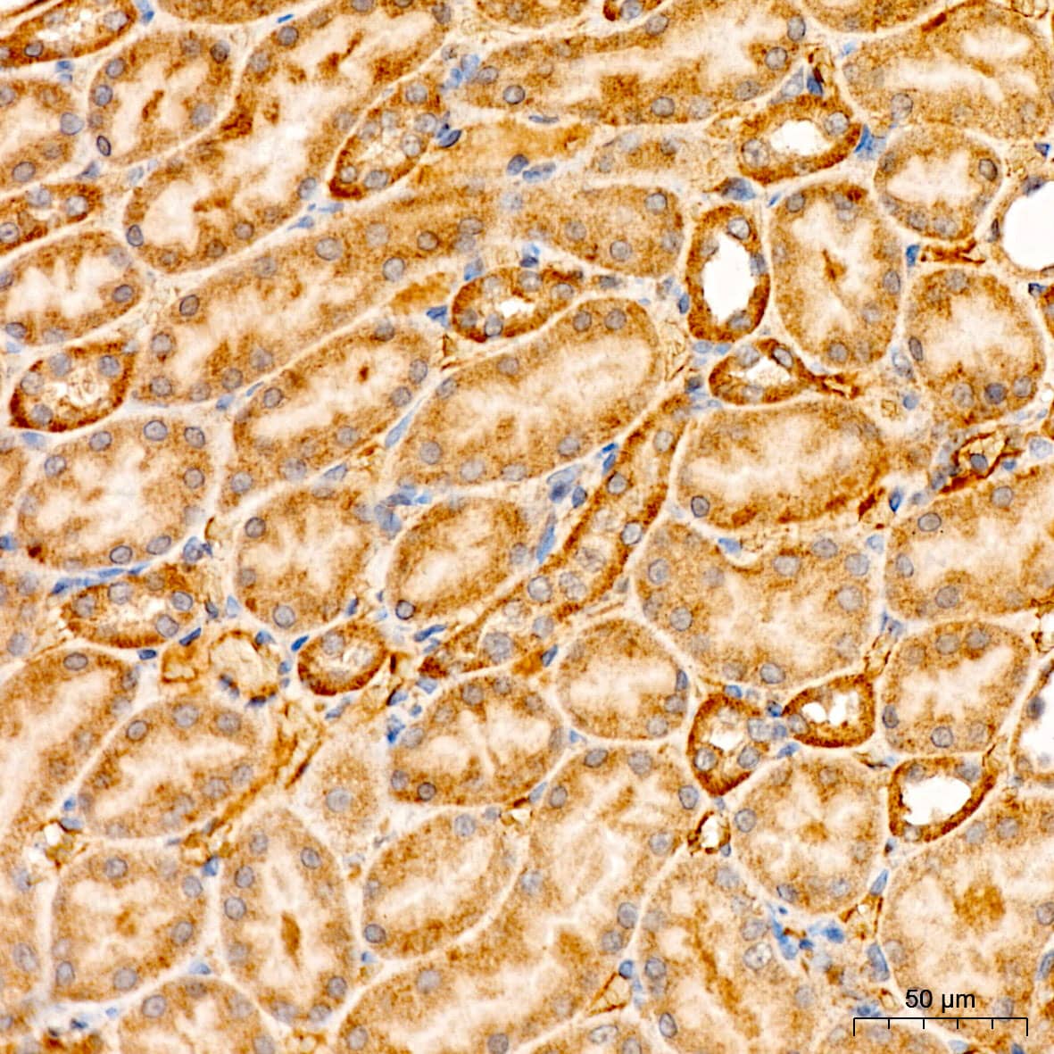 Immunohistochemistry: XRCC6BP1 Antibody [NBP3-35282] - Immunohistochemistry analysis of paraffin-embedded Rat kidney tissue using XRCC6BP1 Rabbit pAb at a dilution of 1:100 (40x lens). High pressure antigen retrieval was performed with 0.01 M citrate buffer (pH 6.0) prior to IHC staining.
