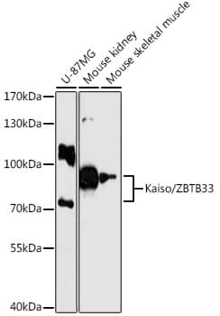 Western Blot: Kaiso Antibody [NBP3-35285] - Western blot analysis of various lysates using Kaiso Rabbit pAb at 1:3000 dilution.Secondary antibody: HRP-conjugated Goat anti-Rabbit IgG (H+L) at 1:10000 dilution.Lysates/proteins: 25ug per lane.Blocking buffer: 3% nonfat dry milk in TBST.Detection: ECL Enhanced Kit.Exposure time: 90s.