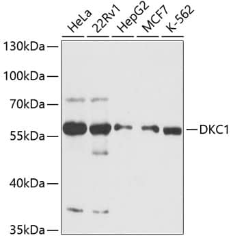 Western Blot: DKC1 Antibody [NBP3-35287] - Western blot analysis of various lysates using DKC1 Rabbit pAb at 1:3000 dilution.Secondary antibody: HRP-conjugated Goat anti-Rabbit IgG (H+L) at 1:10000 dilution.Lysates/proteins: 25ug per lane.Blocking buffer: 3% nonfat dry milk in TBST.Detection: ECL Basic Kit.Exposure time: 60s.