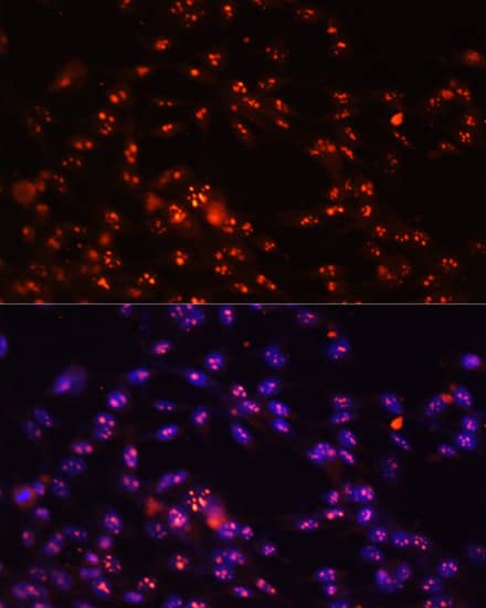 Immunocytochemistry/ Immunofluorescence: DKC1 Antibody [NBP3-35287] - Immunofluorescence analysis of NIH-3T3 cells using DKC1 Rabbit pAb at dilution of 1:100. Secondary antibody: Cy3-conjugated Goat anti-Rabbit IgG (H+L) at 1:500 dilution. Blue: DAPI for nuclear staining.