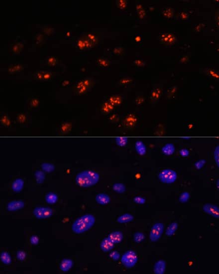 Immunocytochemistry/ Immunofluorescence: DKC1 Antibody [NBP3-35287] - Immunofluorescence analysis of U-2 OS cells using DKC1 Rabbit pAb at dilution of 1:100. Secondary antibody: Cy3-conjugated Goat anti-Rabbit IgG (H+L) at 1:500 dilution. Blue: DAPI for nuclear staining.