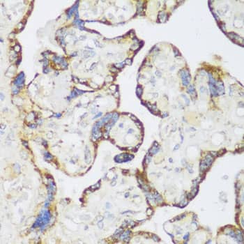 Western Blot: ECH1 Antibody [NBP3-35289] - Western blot analysis of lysates from Mouse heart using ECH1 Rabbit pAb at 1:2000 dilution.Secondary antibody: HRP-conjugated Goat anti-Rabbit IgG (H+L) at 1:10000 dilution.Lysates/proteins: 25 ug per lane.Blocking buffer: 3% nonfat dry milk in TBST.Detection: ECL Basic Kit.Exposure time: 60s.