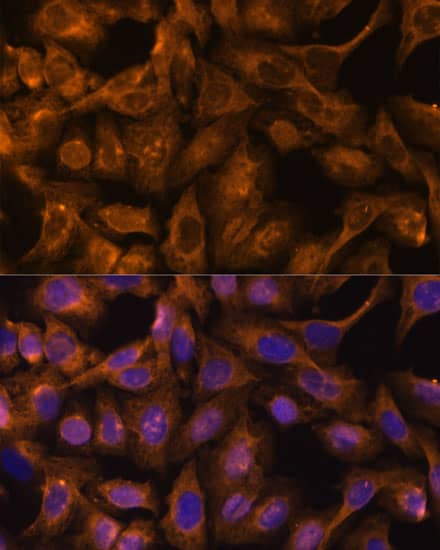Immunocytochemistry/ Immunofluorescence: Septin-5 Antibody [NBP3-35293] - Immunofluorescence analysis of U-2 OS cells using Septin-5 Rabbit pAb at dilution of 1:100. Secondary antibody: Cy3-conjugated Goat anti-Rabbit IgG (H+L) at 1:500 dilution. Blue: DAPI for nuclear staining.