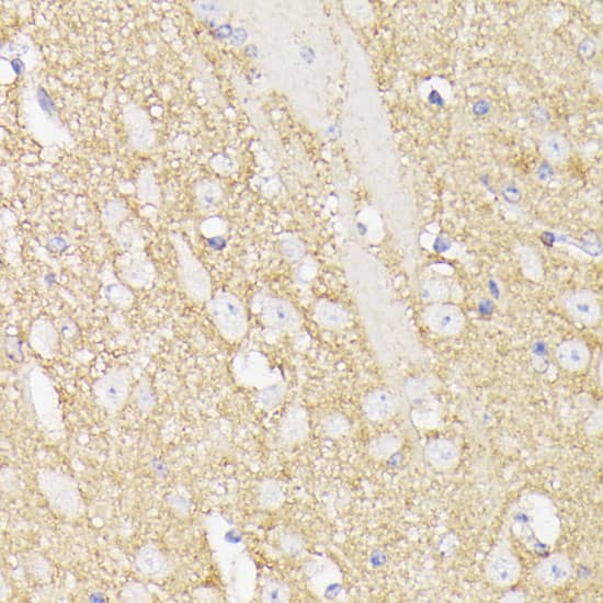 Immunohistochemistry: Septin-5 Antibody [NBP3-35293] - Immunohistochemistry analysis of paraffin-embedded Mouse brain using Septin-5 Rabbit pAb at dilution of 1:100 (40x lens). Microwave antigen retrieval performed with 0.01M PBS Buffer (pH 7.2) prior to IHC staining.